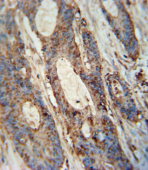 FAM46A Antibody in Immunohistochemistry (Paraffin) (IHC (P))