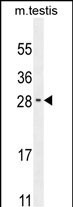 RELL2 Antibody in Western Blot (WB)