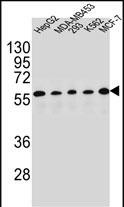 PAX1 Antibody in Western Blot (WB)