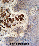 COL19A1 Antibody in Immunohistochemistry (Paraffin) (IHC (P))