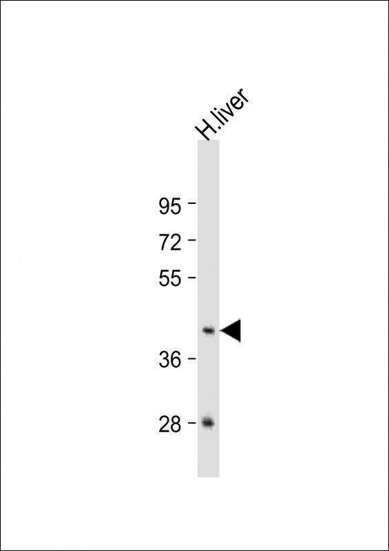 GNA15 Antibody in Western Blot (WB)