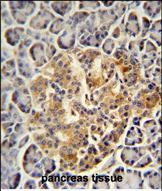 PRSS3 Antibody in Immunohistochemistry (Paraffin) (IHC (P))