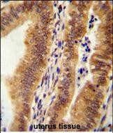 KIAA1609 Antibody in Immunohistochemistry (Paraffin) (IHC (P))