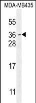 MYCT1 Antibody in Western Blot (WB)