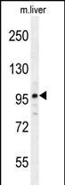 NARG2 Antibody in Western Blot (WB)