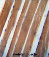 NDUFA11 Antibody in Immunohistochemistry (Paraffin) (IHC (P))