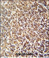 ZNF98 Antibody in Immunohistochemistry (Paraffin) (IHC (P))