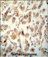 TTC16 Antibody in Immunohistochemistry (Paraffin) (IHC (P))