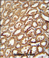 DEGS2 Antibody in Immunohistochemistry (Paraffin) (IHC (P))