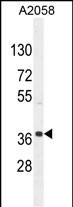 NKAPL Antibody in Western Blot (WB)