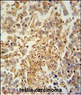 TEX9 Antibody in Immunohistochemistry (Paraffin) (IHC (P))
