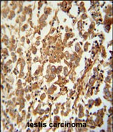 SPATC1 Antibody in Immunohistochemistry (Paraffin) (IHC (P))