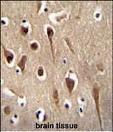 FBXO39 Antibody in Immunohistochemistry (Paraffin) (IHC (P))
