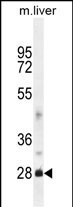 DNAJB8 Antibody in Western Blot (WB)