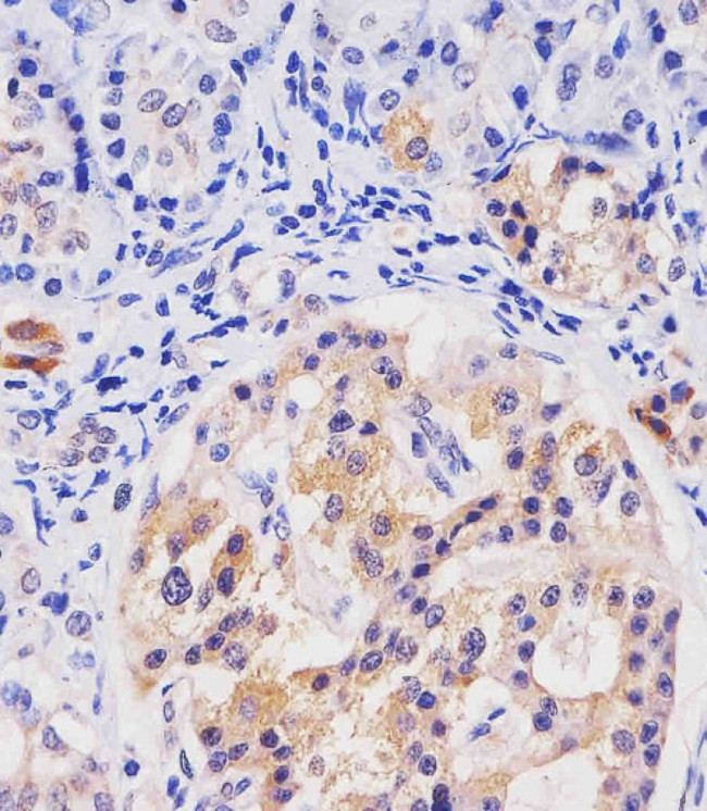 HHLA2 Antibody in Immunohistochemistry (Paraffin) (IHC (P))