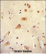 RICH2 Antibody in Immunohistochemistry (Paraffin) (IHC (P))