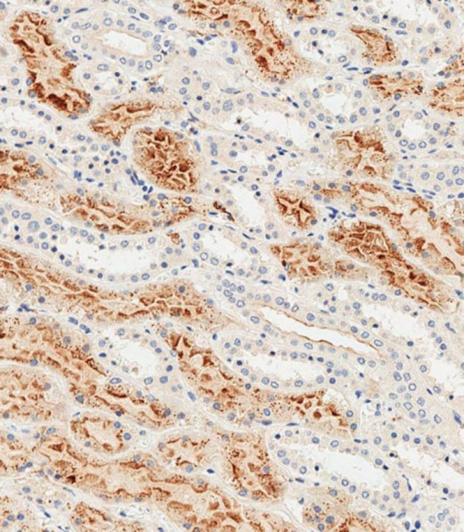 Folate Receptor alpha Antibody in Immunohistochemistry (Paraffin) (IHC (P))