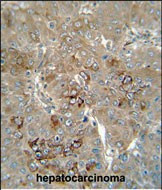 CES4 Antibody in Immunohistochemistry (Paraffin) (IHC (P))