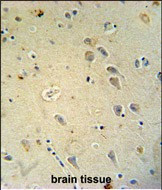 GluR4 Antibody in Immunohistochemistry (Paraffin) (IHC (P))