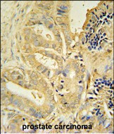 TLL1 Antibody in Immunohistochemistry (Paraffin) (IHC (P))