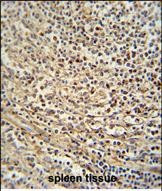 GSDMC Antibody in Immunohistochemistry (Paraffin) (IHC (P))