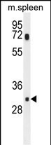MCAR1 Antibody in Western Blot (WB)