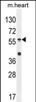 SP8 Antibody in Western Blot (WB)
