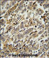 ASB17 Antibody in Immunohistochemistry (Paraffin) (IHC (P))