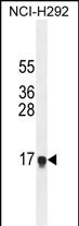 HEPN1 Antibody in Western Blot (WB)