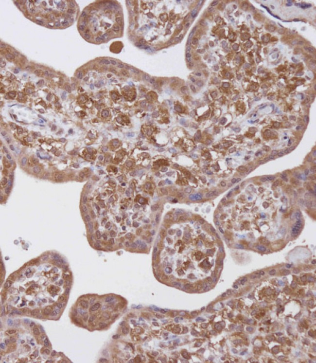 WDR41 Antibody in Immunohistochemistry (Paraffin) (IHC (P))