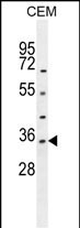 LDHAL6A Antibody in Western Blot (WB)
