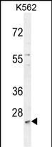 MCART2 Antibody in Western Blot (WB)