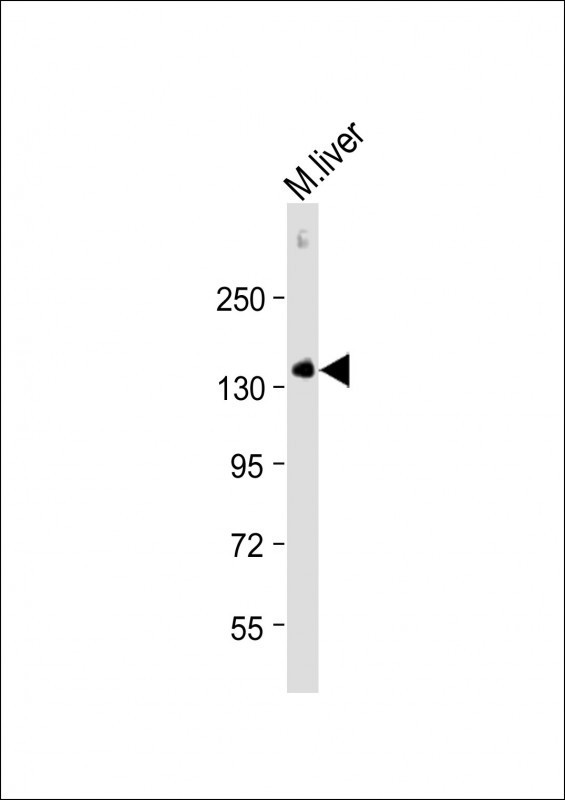 CD31 Antibody in Western Blot (WB)