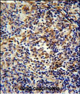 CASKIN2 Antibody in Immunohistochemistry (Paraffin) (IHC (P))