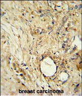 ITIH5 Antibody in Immunohistochemistry (Paraffin) (IHC (P))