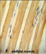 BCLAF1 Antibody in Immunohistochemistry (Paraffin) (IHC (P))