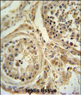 POC1B Antibody in Immunohistochemistry (Paraffin) (IHC (P))