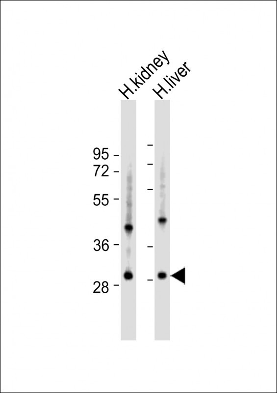 UNC119B Antibody in Western Blot (WB)