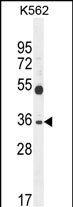 SULT1C3 Antibody in Western Blot (WB)