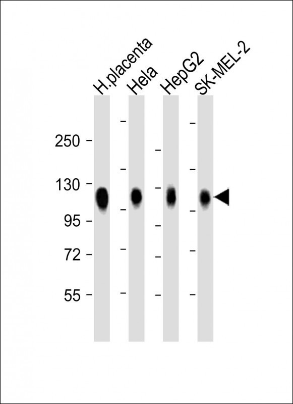 LAMP2 Antibody in Western Blot (WB)