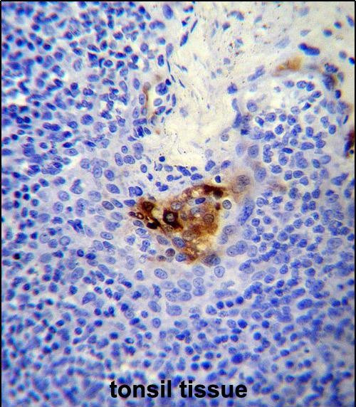 CD146 Antibody in Immunohistochemistry (Paraffin) (IHC (P))