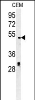DSCC1 Antibody in Western Blot (WB)