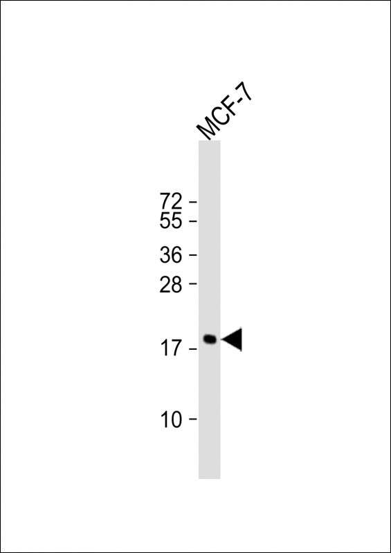 Cofilin Antibody in Western Blot (WB)