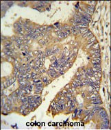 PARD6G Antibody in Immunohistochemistry (Paraffin) (IHC (P))