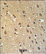 SPRN Antibody in Immunohistochemistry (Paraffin) (IHC (P))