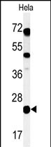 CP054 Antibody in Western Blot (WB)