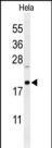 CLEC2B Antibody in Western Blot (WB)