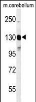 c-Kit Antibody in Western Blot (WB)