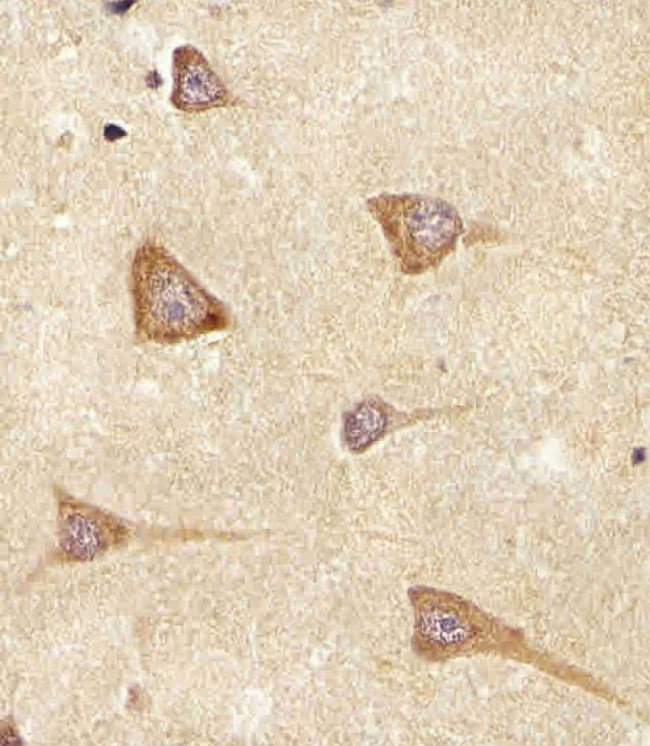 Epiregulin Antibody in Immunohistochemistry (Paraffin) (IHC (P))