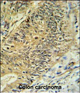 RPS15A Antibody in Immunohistochemistry (Paraffin) (IHC (P))